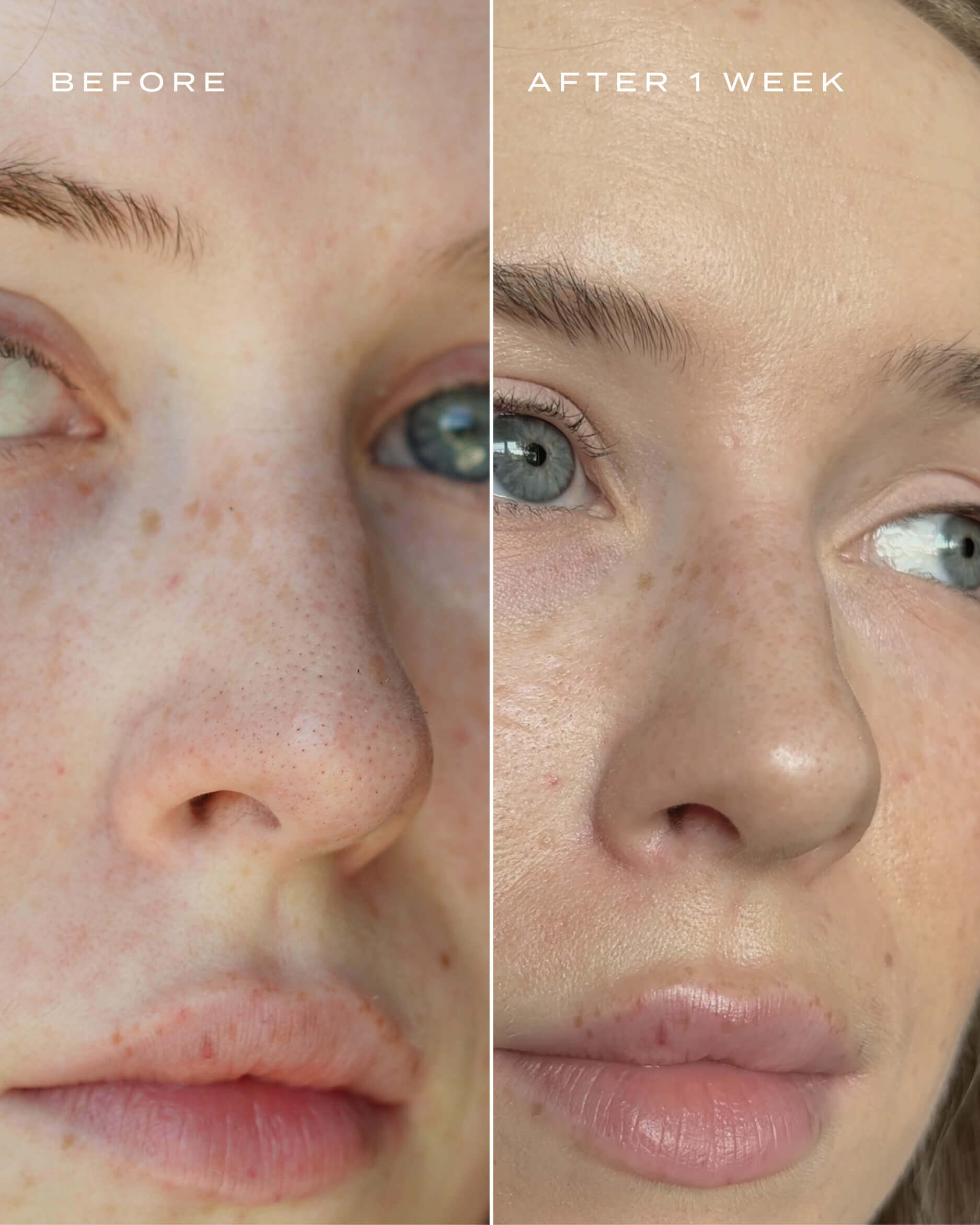 Magic Nose Pore Cleansers